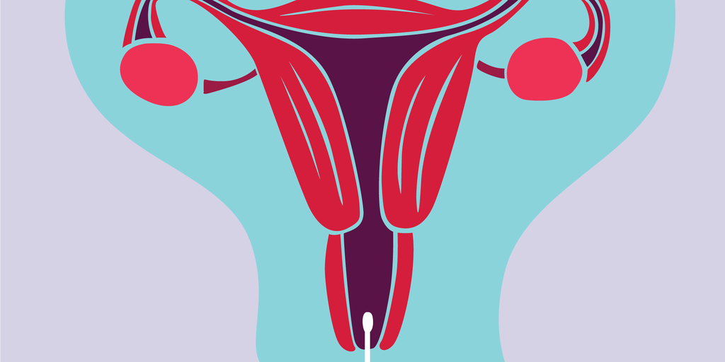 Illustration of the female reproductive organs with a swap taking some cells from the uterus.